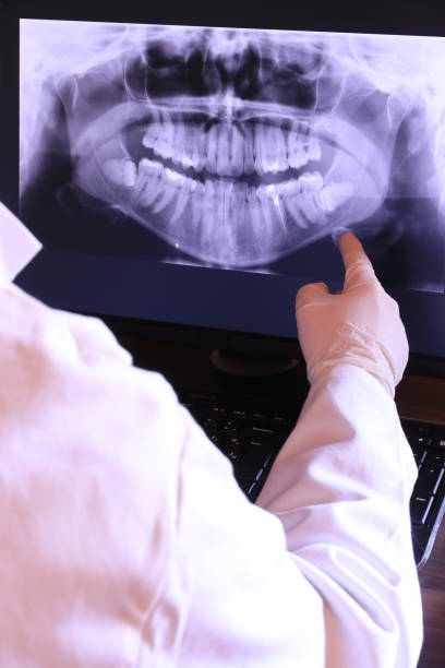 Best Emergency Denture Repair in Emerson, NJ